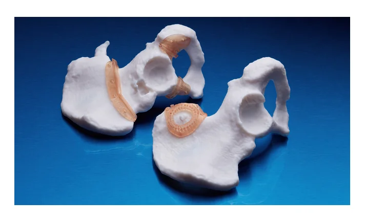 Formlabs BioMed Amber Resin Form 3B/Form 3BL/Form 2 専用の製品画像4